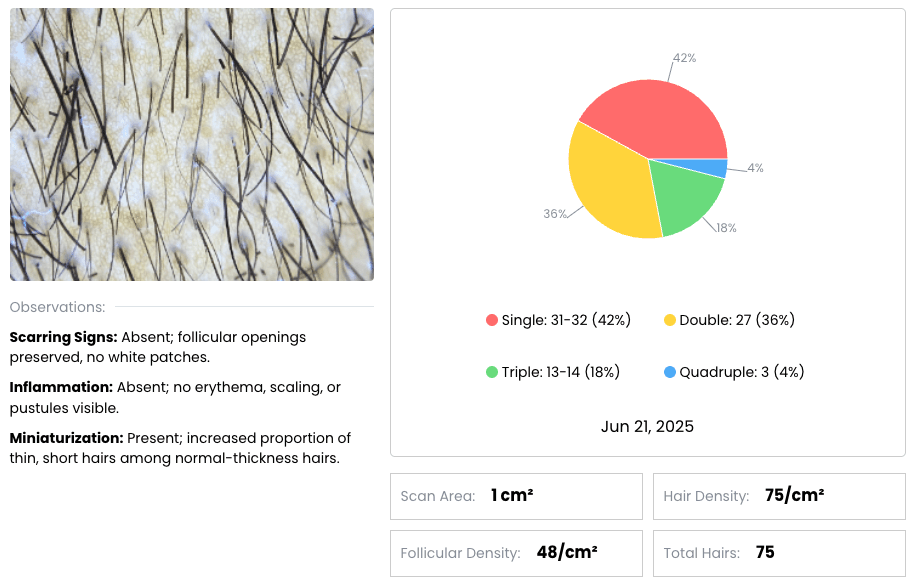 Ai Results Preview