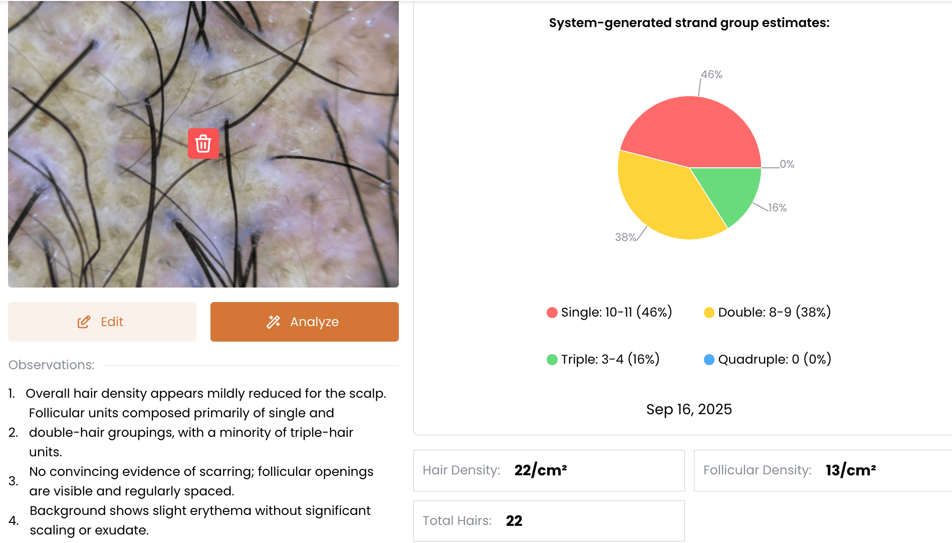 AI Summary Preview
