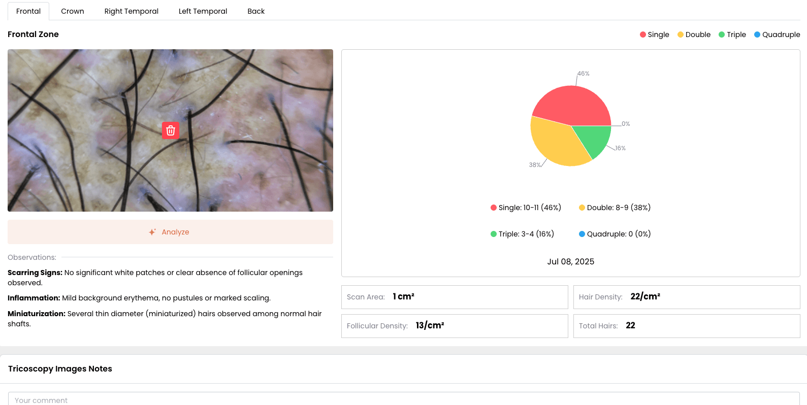 Ai Report