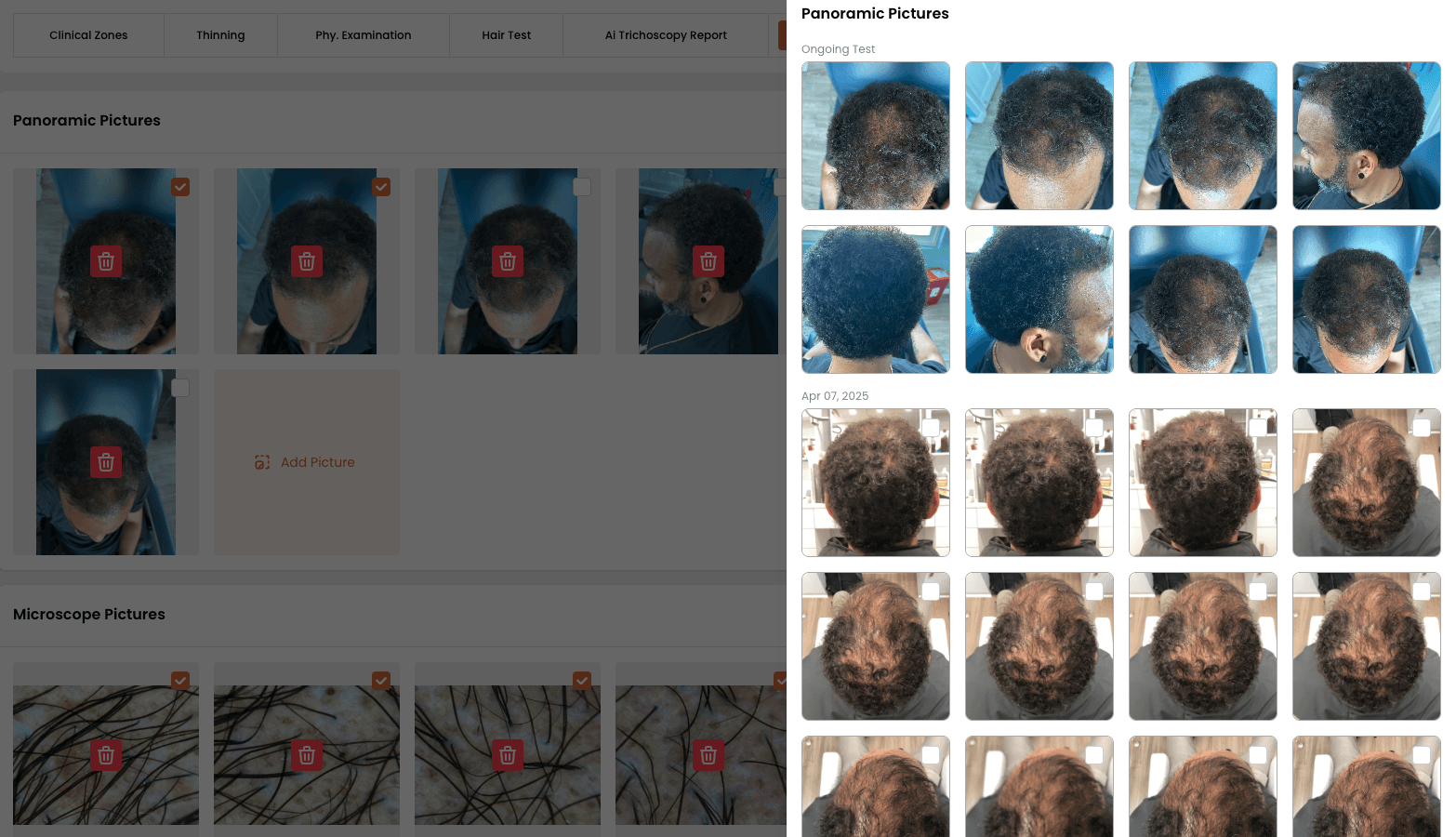 Scalp Pictures