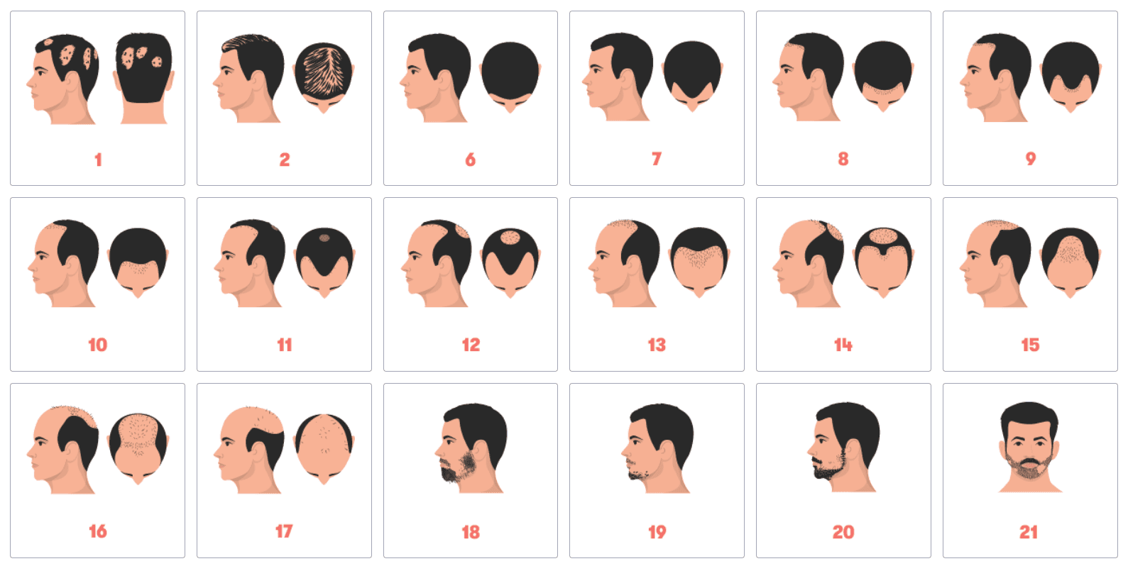 Thinning